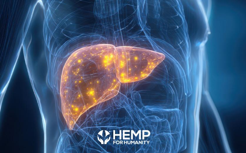 CBD and CBG in Fatty Liver Research: Promising Results, but Not Yet a Treatment